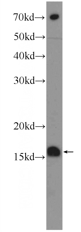 HEK-293 cells were subjected to SDS PAGE followed by western blot with Catalog No:112813(MRPL14 Antibody) at dilution of 1:300
