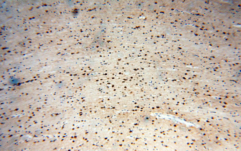 Immunohistochemical of paraffin-embedded human brain using Catalog No:111584(ICA1L antibody) at dilution of 1:50 (under 10x lens)