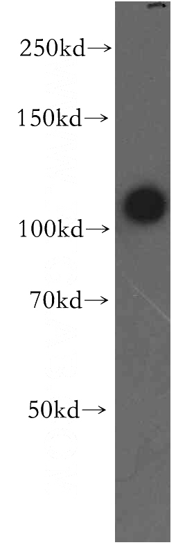 HeLa cells were subjected to SDS PAGE followed by western blot with Catalog No:115685(STAT2 antibody) at dilution of 1:500