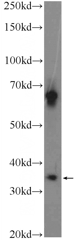 mouse testis tissue were subjected to SDS PAGE followed by western blot with Catalog No:108679(C1orf56 Antibody) at dilution of 1:600