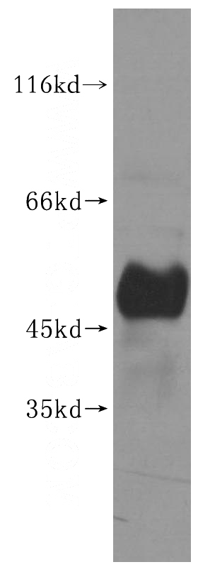mouse thymus tissue were subjected to SDS PAGE followed by western blot with Catalog No:116562(UHMK1 antibody) at dilution of 1:500