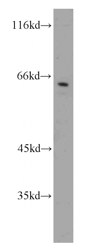 Jurkat cells were subjected to SDS PAGE followed by western blot with Catalog No:108923(CAMKK1 antibody) at dilution of 1:1000