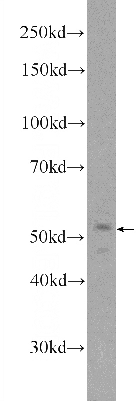 A431 cells were subjected to SDS PAGE followed by western blot with Catalog No:111619(IFIT2 Antibody) at dilution of 1:300