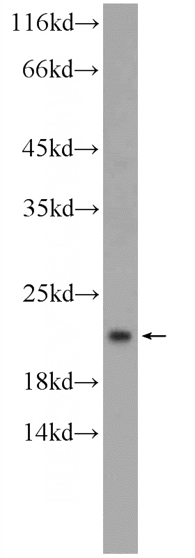 human brain tissue were subjected to SDS PAGE followed by western blot with Catalog No:114545(RAP1B antibody) at dilution of 1:300
