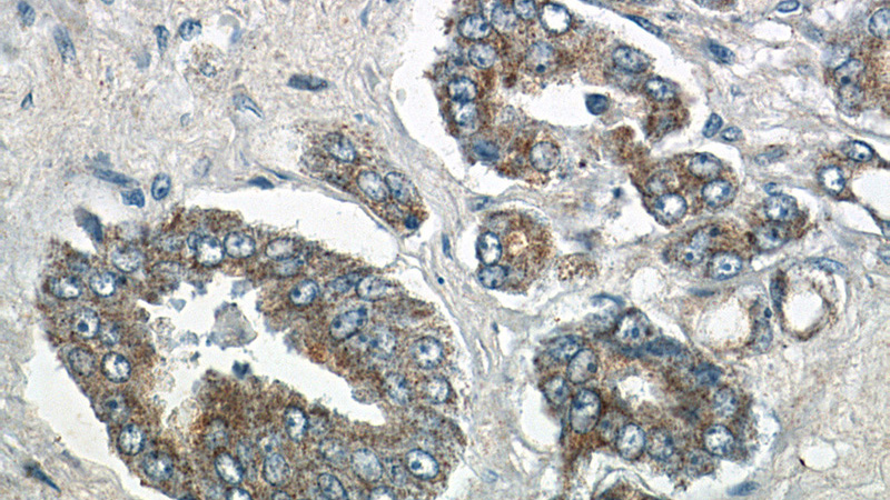 Immunohistochemistry of paraffin-embedded human prostate hyperplasia slide using Catalog No:115637(STAC2 Antibody) at dilution of 1:50