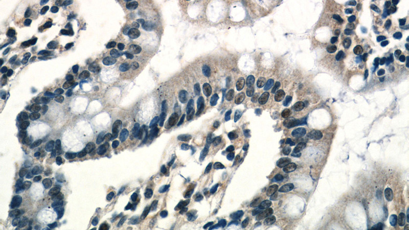 Immunohistochemistry of paraffin-embedded human small intestine tissue slide using Catalog No:114822(RPP25 Antibody) at dilution of 1:50 (under 40x lens)