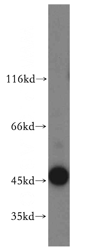 HT-1080 cells were subjected to SDS PAGE followed by western blot with Catalog No:112804(MRI1 antibody) at dilution of 1:500