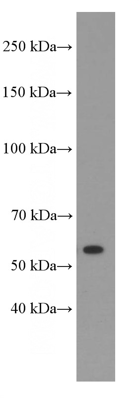HeLa cells were subjected to SDS PAGE followed by western blot with Catalog No:107529(Sestrin2 Antibody) at dilution of 1:2000