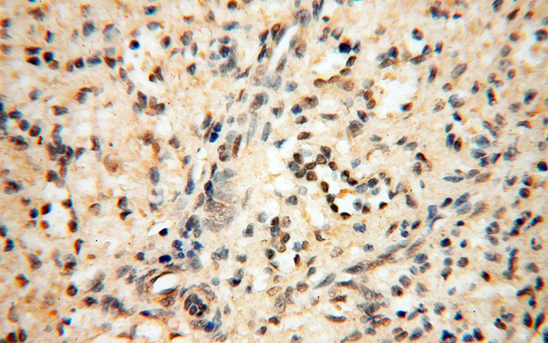 Immunohistochemical of paraffin-embedded human spleen using Catalog No:110355(ERG antibody) at dilution of 1:25 (under 40x lens)