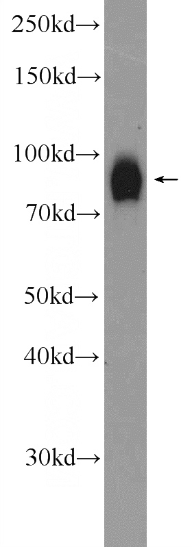 human testis tissue were subjected to SDS PAGE followed by western blot with Catalog No:113841(PIWIL1 Antibody) at dilution of 1:600