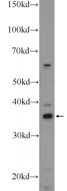 SH-SY5Y cells were subjected to SDS PAGE followed by western blot with Catalog No:110869(GAS1 Antibody) at dilution of 1:300