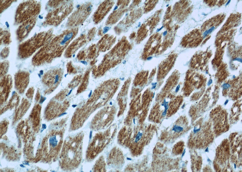 Immunohistochemical of paraffin-embedded human heart using Catalog No:116635(UQCRC1 antibody) at dilution of 1:100 (under 40x lens)