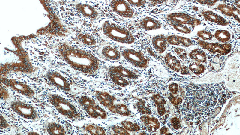Immunohistochemical of paraffin-embedded human stomach using Catalog No:113682(PDIA6 antibody) at dilution of 1:50 (under 10x lens)