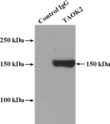 IP Result of anti-TAOK2 (IP:Catalog No:115848, 4ug; Detection:Catalog No:115848 1:500) with HEK-293 cells lysate 3000ug.