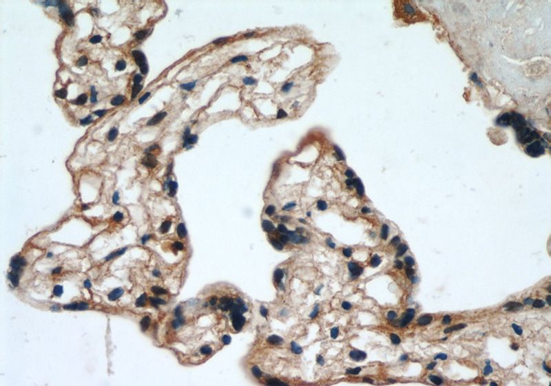 Immunohistochemical of paraffin-embedded human placenta using Catalog No:110383(EPHB4 antibody) at dilution of 1:50 (under 40x lens)