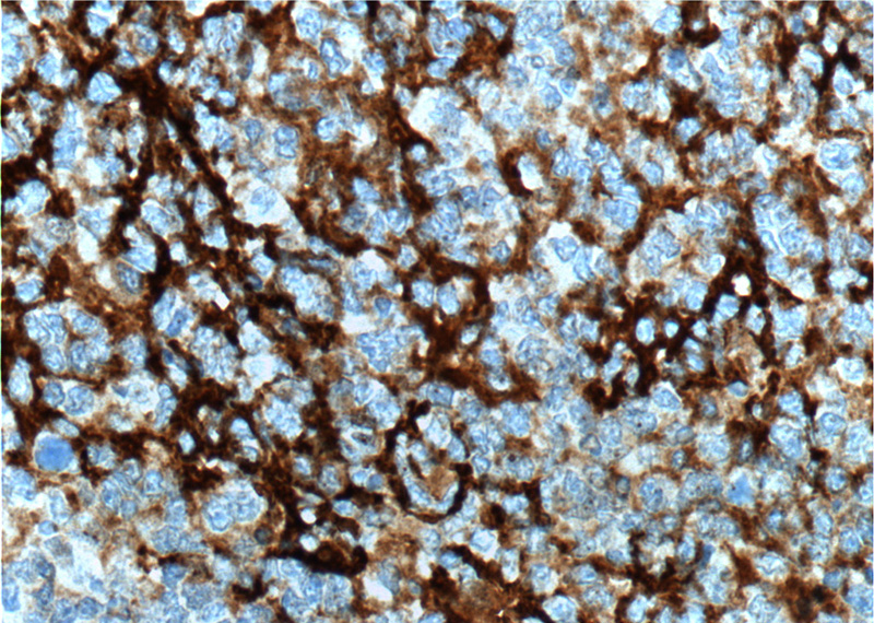 Immunohistochemistry of paraffin-embedded human tonsillitis tissue slide using Catalog No:109011(CD23,FCER2 Antibody) at dilution of 1:200 (under 40x lens). heat mediated antigen retrieved with Tris-EDTA buffer(pH9).