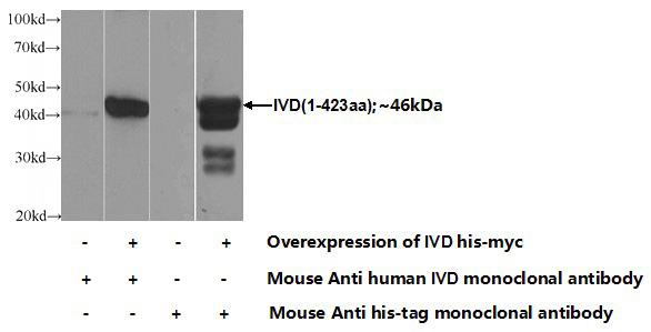 Transfected HEK-293 cells were subjected to SDS PAGE followed by western blot with Catalog No:107356(IVD Antibody) at dilution of 1:1000