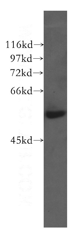 HeLa cells were subjected to SDS PAGE followed by western blot with Catalog No:109734(C1QTNF6 antibody) at dilution of 1:500