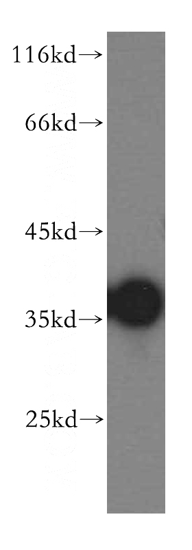 human liver tissue were subjected to SDS PAGE followed by western blot with Catalog No:109460(CPOX antibody) at dilution of 1:500
