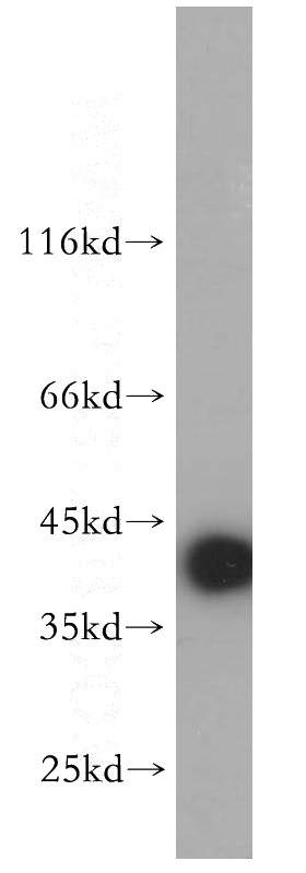 human brain tissue were subjected to SDS PAGE followed by western blot with Catalog No:114136(PPM1K antibody) at dilution of 1:500