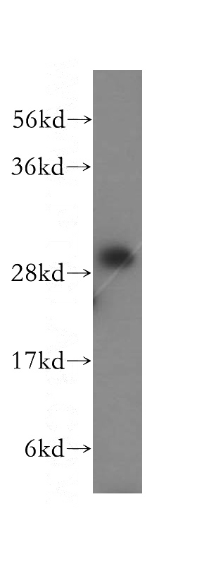 HepG2 cells were subjected to SDS PAGE followed by western blot with Catalog No:109925(DHRS4 antibody) at dilution of 1:400