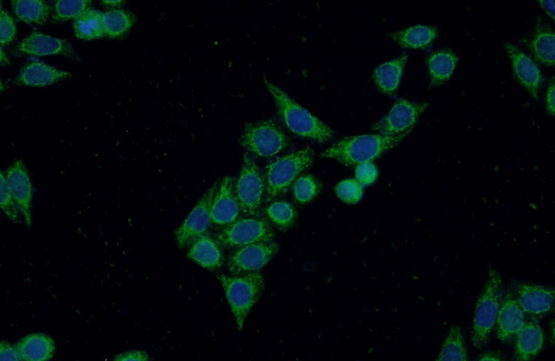 Immunofluorescent analysis of HeLa cells using Catalog No:109938(DIAPH3 Antibody) at dilution of 1:50 and Alexa Fluor 488-congugated AffiniPure Goat Anti-Rabbit IgG(H+L)