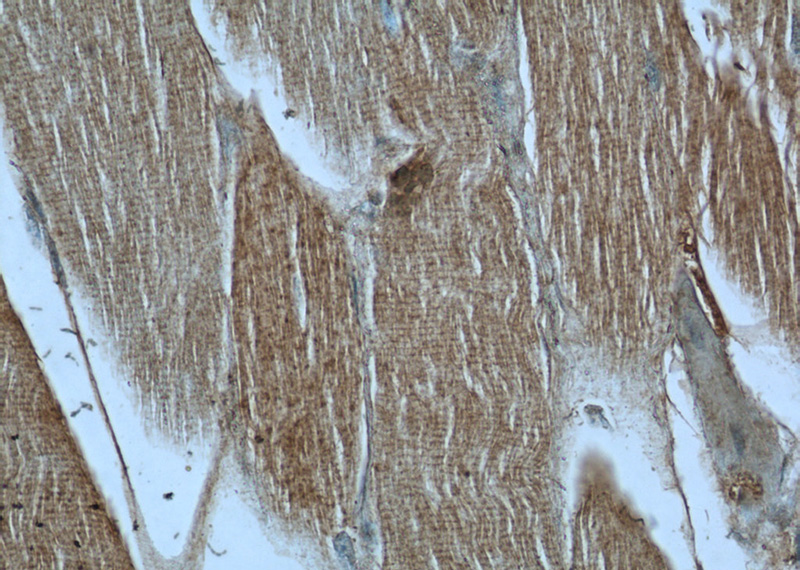 Immunohistochemistry of paraffin-embedded human skeletal muscle tissue slide using Catalog No:109626(CUL7 Antibody) at dilution of 1:50 (under 40x lens)