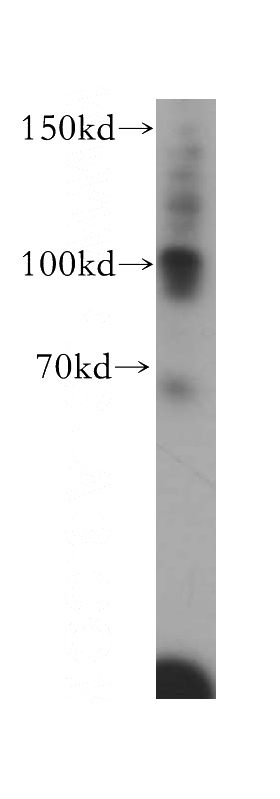 HepG2 cells were subjected to SDS PAGE followed by western blot with Catalog No:113940(Angiostatin antibody) at dilution of 1:300
