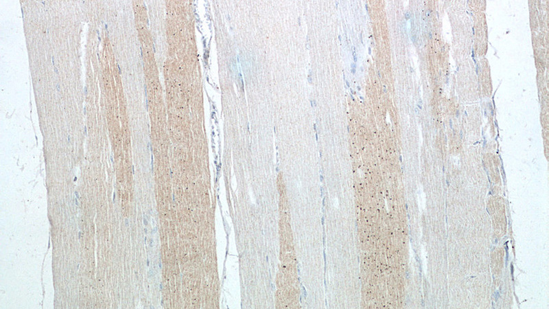 Immunohistochemistry of paraffin-embedded human skeletal muscle tissue slide using Catalog No:111959(ITPKC Antibody) at dilution of 1:50 (under 10x lens)