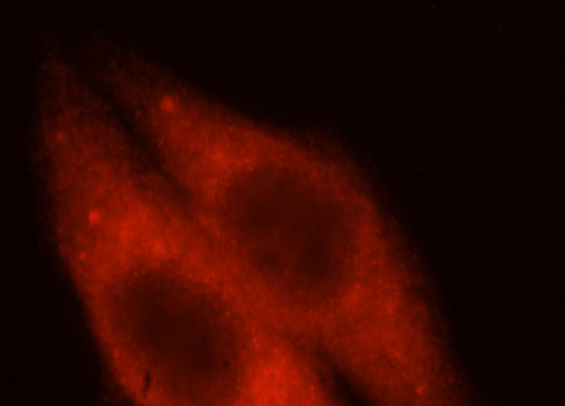 Immunofluorescent analysis of HepG2 cells, using HMGCS1 antibody Catalog No:111485 at 1:25 dilution and Rhodamine-labeled goat anti-rabbit IgG (red).