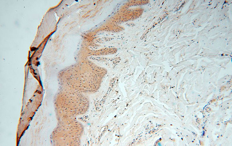Immunohistochemical of paraffin-embedded human skin using Catalog No:113777(PGAM2 antibody) at dilution of 1:100 (under 10x lens)