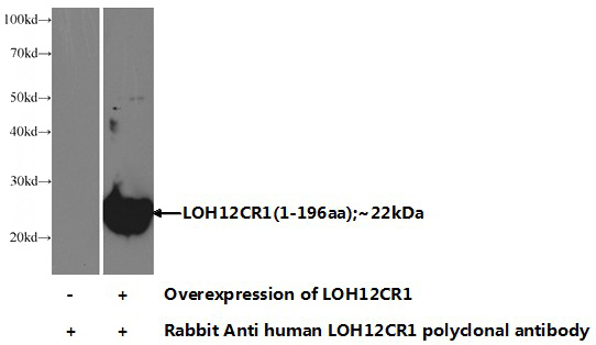 Transfected HEK-293 cells were subjected to SDS PAGE followed by western blot with Catalog No:112294(LOH12CR1 Antibody) at dilution of 1:1000