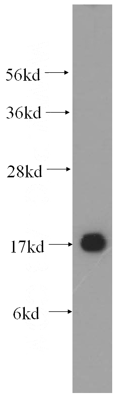 HEK-293 cells were subjected to SDS PAGE followed by western blot with Catalog No:116511(UBE2I-Specific antibody) at dilution of 1:400