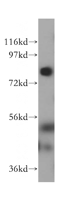 HeLa cells were subjected to SDS PAGE followed by western blot with Catalog No:112281(LMF2 antibody) at dilution of 1:800