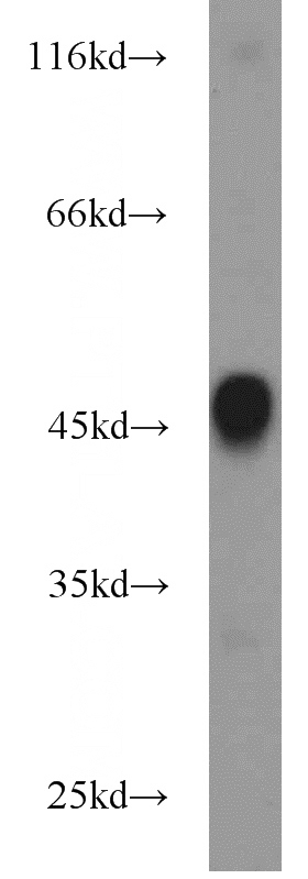 mouse skin tissue were subjected to SDS PAGE followed by western blot with Catalog No:112132(KRT36 antibody) at dilution of 1:1000