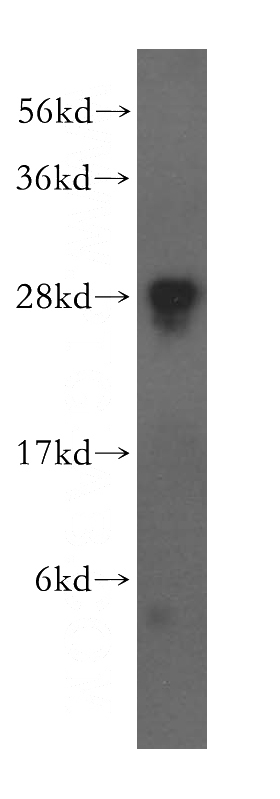 HEK-293 cells were subjected to SDS PAGE followed by western blot with Catalog No:110670(FKBP14 antibody) at dilution of 1:500