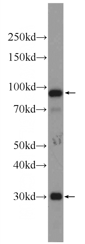 human blood tissue were subjected to SDS PAGE followed by western blot with Catalog No:108689(C1R Antibody) at dilution of 1:1000