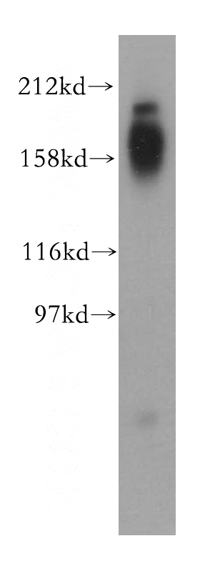 HEK-293 cells were subjected to SDS PAGE followed by western blot with Catalog No:113209(NPC1 antibody) at dilution of 1:1000