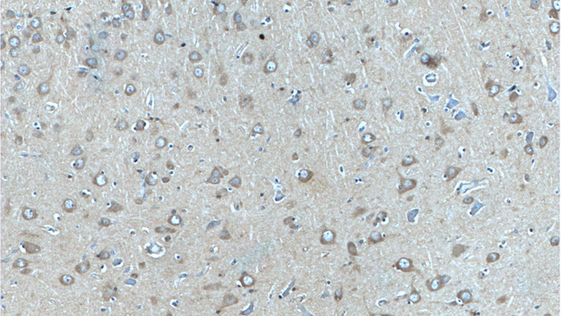 Immunohistochemistry of paraffin-embedded human brain tissue slide using Catalog No:108758(CACNA1D Antibody) at dilution of 1:50 (under 10x lens)