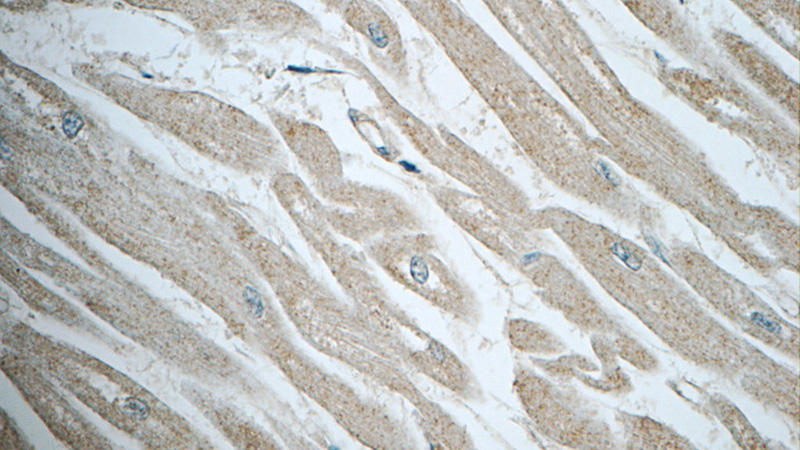 Immunohistochemistry of paraffin-embedded human heart tissue slide using Catalog No:113038(NAP1;NCKAP1 Antibody) at dilution of 1:50 (under 40x lens)