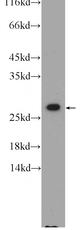 HEK-293 cells were subjected to SDS PAGE followed by western blot with Catalog No:108936(CAPNS1 Antibody) at dilution of 1:600