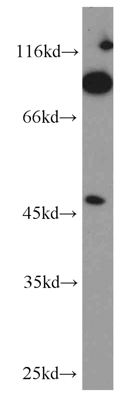 mouse kidney tissue were subjected to SDS PAGE followed by western blot with Catalog No:110912(GCNT2 antibody) at dilution of 1:500