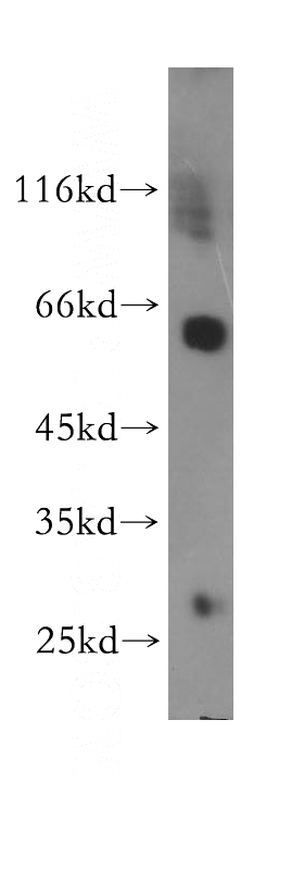 Jurkat cells were subjected to SDS PAGE followed by western blot with Catalog No:109474(CORO1A antibody) at dilution of 1:600
