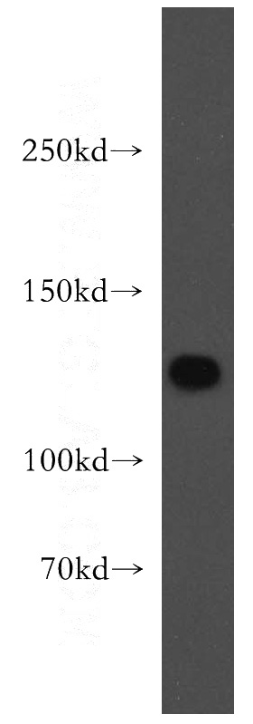 K-562 cells were subjected to SDS PAGE followed by western blot with Catalog No:115133(SF3A1 antibody) at dilution of 1:1000
