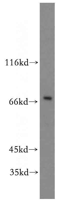 SH-SY5Y cells were subjected to SDS PAGE followed by western blot with Catalog No:115517(SOX5 antibody) at dilution of 1:400