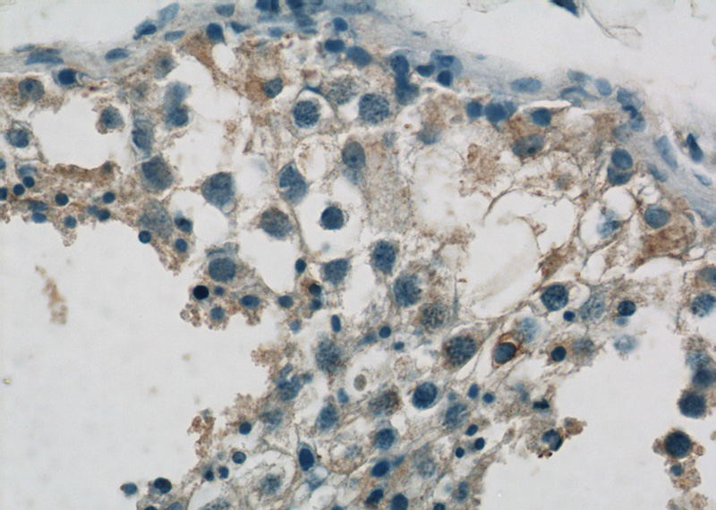 Immunohistochemistry of paraffin-embedded human testis tissue slide using Catalog No:115642(SPRED2 Antibody) at dilution of 1:50 (under 40x lens)