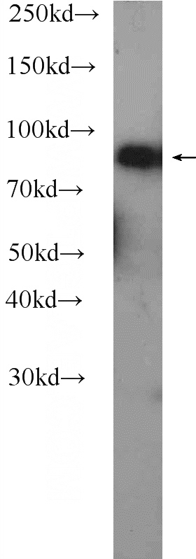 human blood tissue were subjected to SDS PAGE followed by western blot with Catalog No:108727(C4A Antibody) at dilution of 1:3000