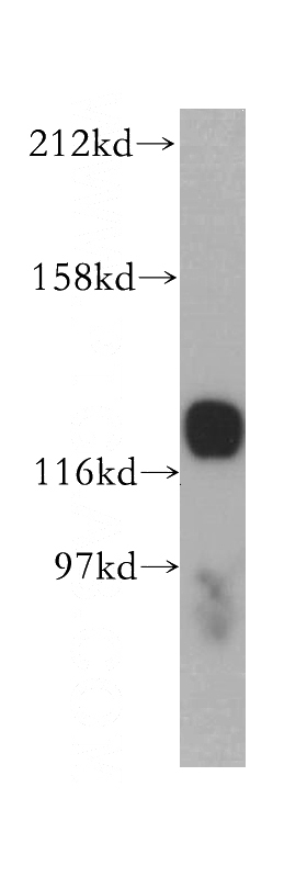 Jurkat cells were subjected to SDS PAGE followed by western blot with Catalog No:111512(HNRNPU antibody) at dilution of 1:500