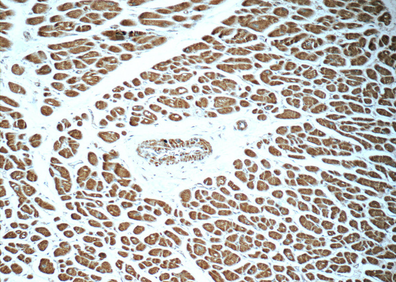 Immunohistochemistry of paraffin-embedded human heart tissue slide using Catalog No:114430(RAB31-specific Antibody) at dilution of 1:50 (under 10x lens)