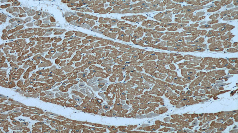 Immunohistochemical of paraffin-embedded human heart using Catalog No:107864(ACTC1 antibody) at dilution of 1:100 (under 10x lens)